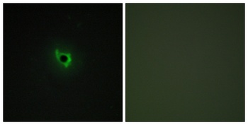 EphA6 rabbit pAb Antibody
