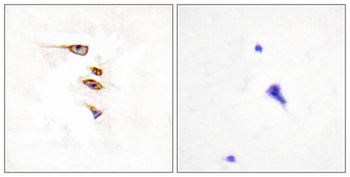 EphA6 rabbit pAb Antibody