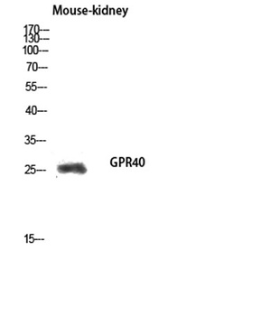 GPR40 rabbit pAb Antibody