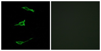 GPR40 rabbit pAb Antibody