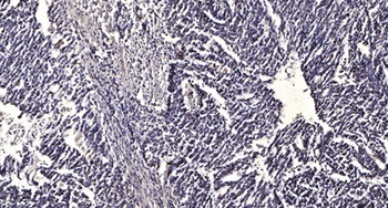 LOST1 rabbit pAb Antibody