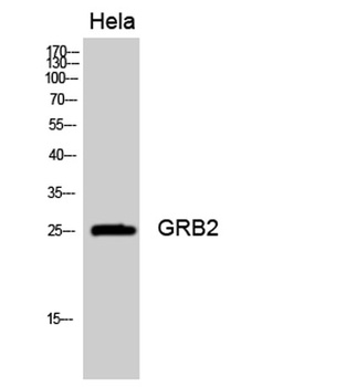 GRB2 rabbit pAb Antibody