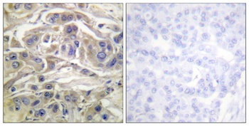 C3G rabbit pAb Antibody