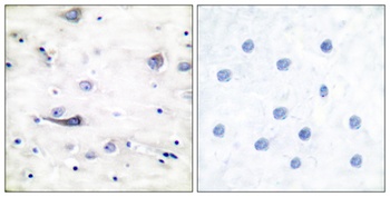 GluR-1 (phospho Ser863) rabbit pAb Antibody