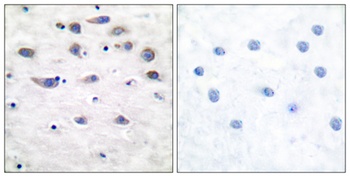 GluR-1 (phospho Ser849) rabbit pAb Antibody