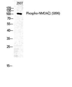 NMDAζ1 (phospho Ser896) rabbit pAb Antibody