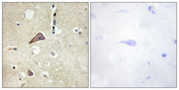 NMDAζ1 (phospho Ser896) rabbit pAb Antibody