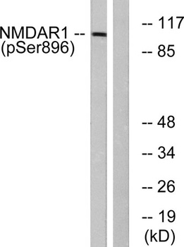 NMDAζ1 (phospho Ser896) rabbit pAb Antibody