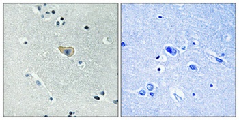 NMDAζ1 (phospho Ser890) rabbit pAb Antibody