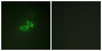 NMDAζ1 rabbit pAb Antibody
