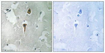 NMDAζ1 rabbit pAb Antibody