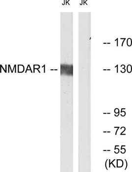 NMDAζ1 rabbit pAb Antibody