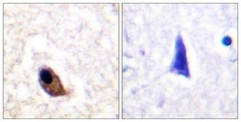 NMDAε1/2 (phospho Tyr1246/1252) rabbit pAb