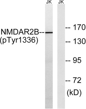 NMDAε2 (phospho Tyr1336) rabbit pAb