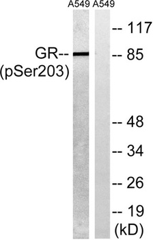 GR (phospho Ser203) rabbit pAb Antibody