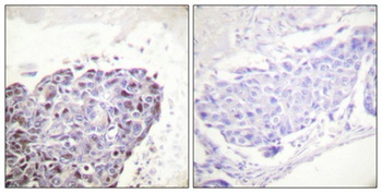 GR rabbit pAb Antibody