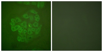 GR rabbit pAb Antibody