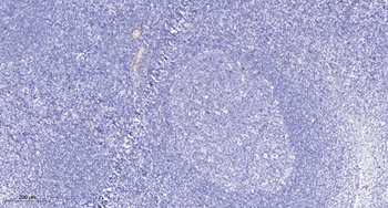TBK1 rabbit pAb Antibody