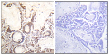 Rac GAP1 (phospho Ser387) rabbit pAb Antibody
