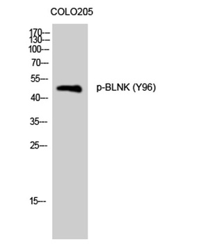 BLNK (phospho Tyr96) rabbit pAb Antibody