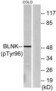 BLNK (phospho Tyr96) rabbit pAb Antibody