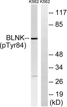 BLNK (phospho Tyr84) rabbit pAb Antibody