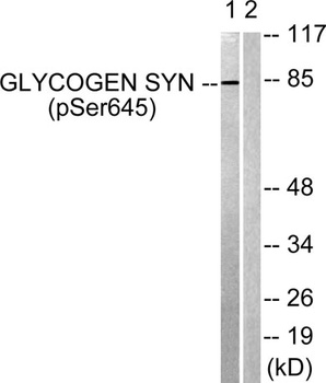 Glycogen Synthase 1 (phospho Ser645) rabbit pAb Antibody