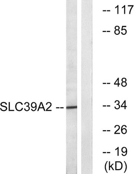 ZIP2 rabbit pAb Antibody