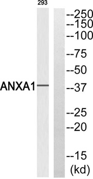 Annexin I rabbit pAb Antibody