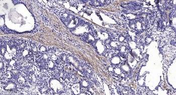 Lck BP-1 rabbit pAb Antibody