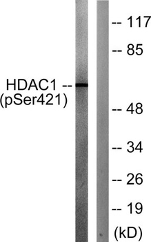 HDAC1 (phospho Ser421) rabbit pAb Antibody