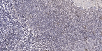HDAC1 (phospho Ser421) rabbit pAb Antibody