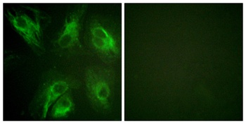 DREAM (phospho Ser63) rabbit pAb Antibody