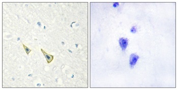 DREAM (phospho Ser63) rabbit pAb Antibody