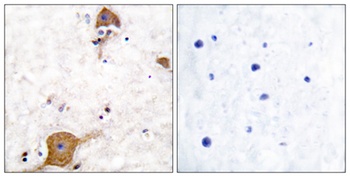 Neuregulin-1 SMDF rabbit pAb Antibody