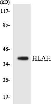 HLA-H rabbit pAb Antibody