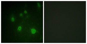 HMG-14 (phospho Ser21) rabbit pAb Antibody