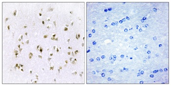 HMG-17 rabbit pAb Antibody