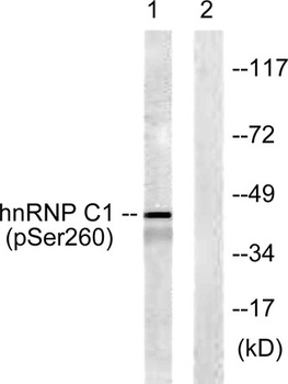 hnRNP C1/2 (phospho Ser260) rabbit pAb Antibody