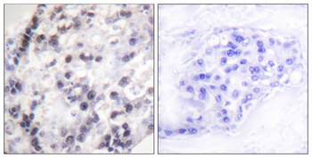 hnRNP C1/2 rabbit pAb Antibody