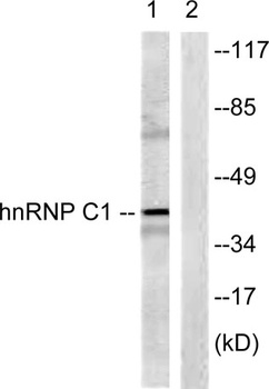 hnRNP C1/2 rabbit pAb Antibody