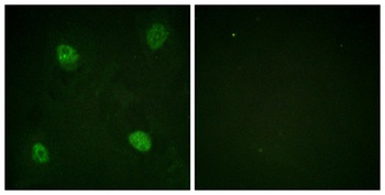 hnRNP D0 (phospho Ser83) rabbit pAb Antibody