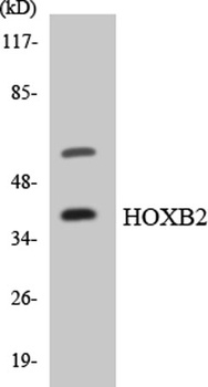 HoxB2 rabbit pAb Antibody