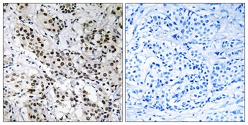 Fe65L rabbit pAb Antibody