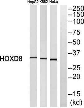 HoxD8 rabbit pAb Antibody