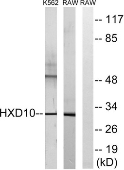 HoxD10 rabbit pAb Antibody