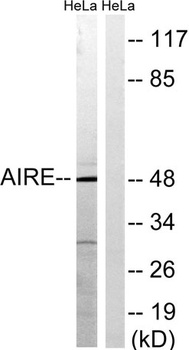 AIRE-1 rabbit pAb Antibody