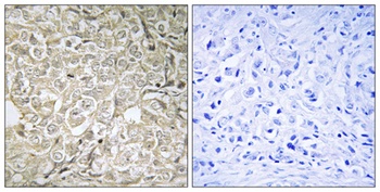 Rab 37 rabbit pAb Antibody