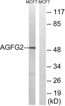 Rabr rabbit pAb Antibody