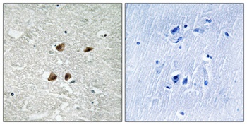 HSF1 (phospho Ser121) rabbit pAb Antibody